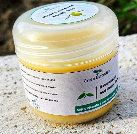 Natural Acne and Pimple Balm